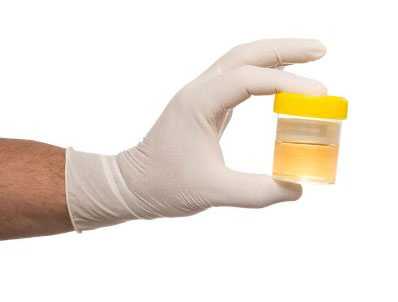 culoarea urinei prostatitei cronice enurezis cu cauze de prostatita