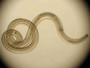 pinworm de la viermi pentru oameni tratamentul paraziților din corpul adult