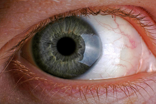 boli oculare și refacerea vederii