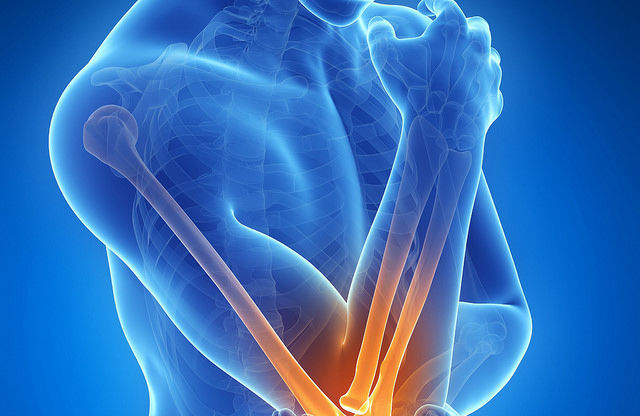 ce este artrita tratamentului articulațiilor genunchiului tratamentul înroșirii articulare
