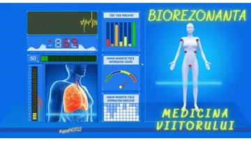 Biorezonanța, medicina viitorului 